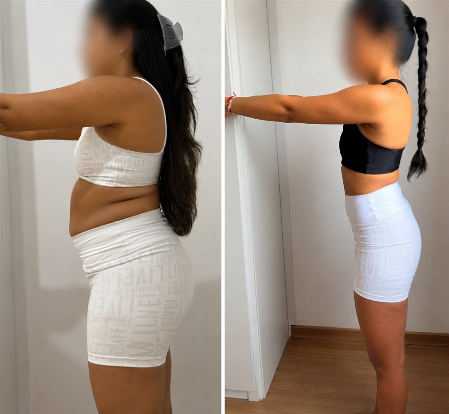 Foto de antes e depois de paciente, rosto preservado