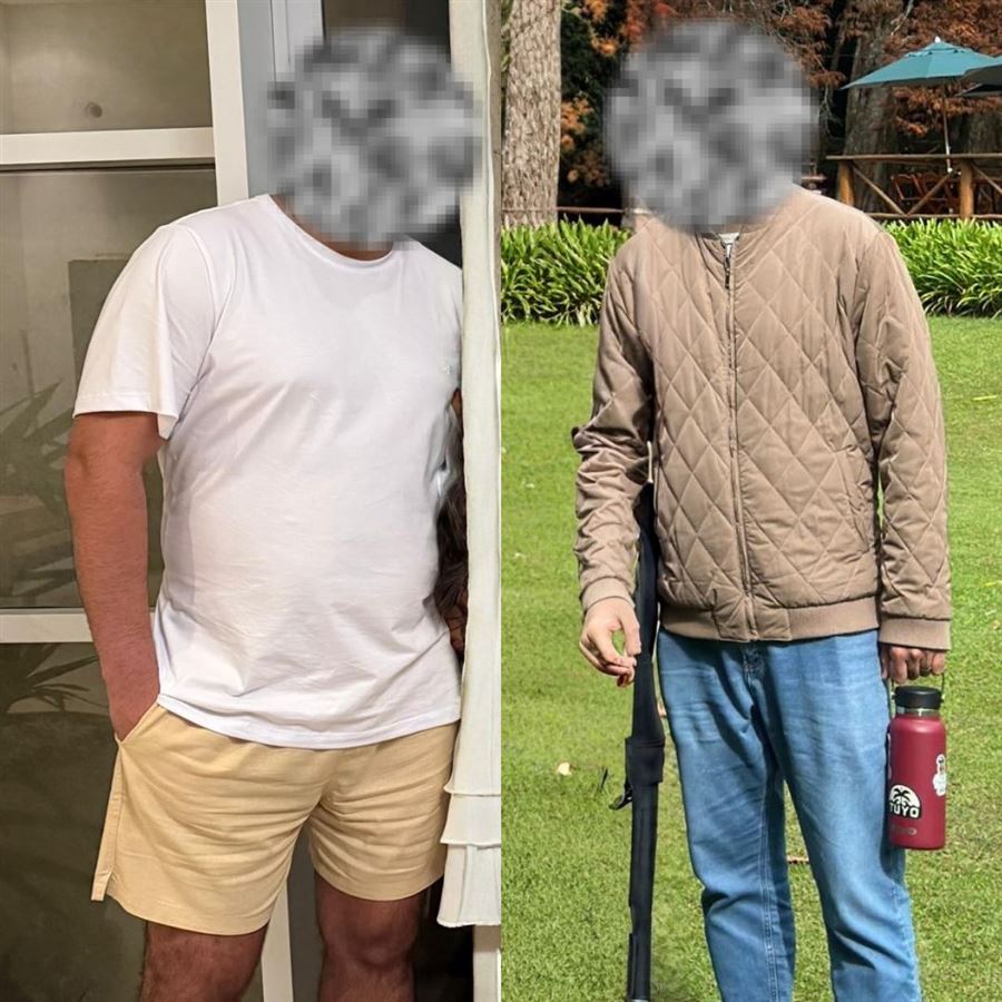 Foto de antes e depois de paciente, rosto preservado