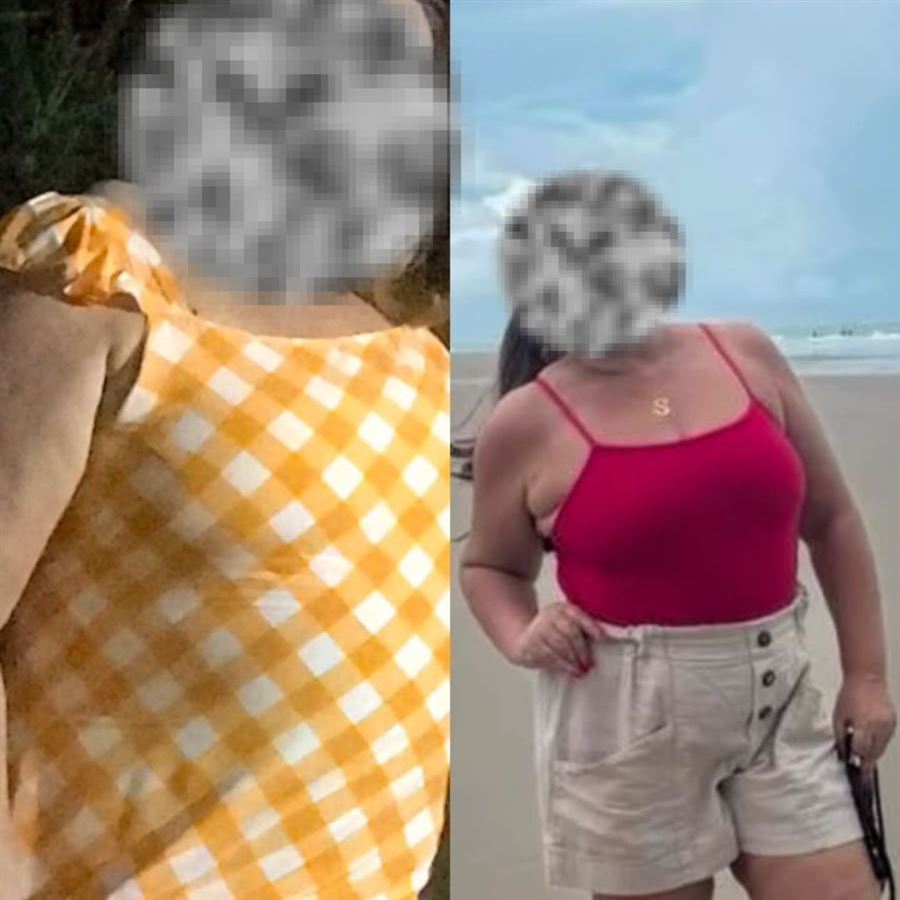 Foto de antes e depois de paciente, rosto preservado