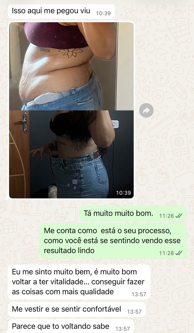 Foto de antes e depois de paciente, rosto preservado